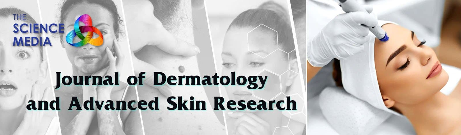 Journal of Dermatology and Advanced Skin Research